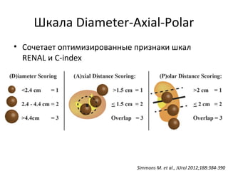 Шкала Diameter-Axial-Polar
• Сочетает оптимизированные признаки шкал
RENAL и С-index
Simmons M. et al., JUrol 2012;188:384-390
 
