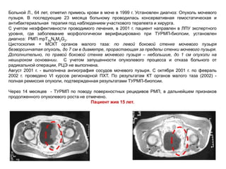 Больной Л., 64 лет, отметил примесь крови в моче в 1999 г. Установлен диагноз: Опухоль мочевого
пузыря. В последующие 23 месяца больному проводилась консервативная гемостатическая и
антибактериальная терапия под наблюдением участкового терапевта и хирурга.
С учетом неэффективности проводимого лечения, в 2001 г. пациент направлен в ЛПУ экспертного
уровня, где заболевание морфологически верифицировано при ТУРМП-биопсии, установлен
диагноз: РМП mрT3aN0M0G2.
Цистоскопия + МСКТ органов малого таза: по левой боковой стенке мочевого пузыря
безворсинчатая опухоль, до 7 см в диаметре, прорастающая за пределы стенки мочевого пузыря.
Дополнительно, по правой боковой стенке мочевого пузыря – небольшие, до 1 см опухоли на
нешироком основании. С учетом запущенности опухолевого процесса и отказа больного от
радикальной операции, РЦЭ не выполнена.
Август 2001 г. - выполнена ангиография сосудов мочевого пузыря. С октября 2001 г. по февраль
2002 г. проведено VI курсов регионарной ПХТ. По результатам КТ органов малого таза (2002) -
полная ремиссия опухоли, подтвержденная результатами ТУРМП-биопсии.
Через 14 месяцев - ТУРМП по поводу поверхностных рецидивов РМП, в дальнейшем признаков
продолженного опухолевого роста не отмечено.
Пациент жив 15 лет.
Октябрь 2001 г. Февраль 2002 г.
 