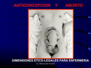 Lic. Mónica Soto Verchér
ANTICONCEPCION Y ABORTO
DIMENSIONES ETICO-LEGALES PARA ENFERMERIA
 