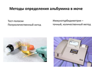 Методы определения альбумина в моче
Иммунотурбидиметрия –
точный, количественный метод
Тест-полоски
Полуколичественный метод
 