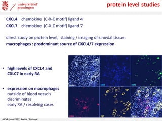 AlCoB, June 2017, Aveiro / Portugal
CXCL4 chemokine (C-X-C motif) ligand 4
CXCL7 chemokine (C-X-C motif) ligand 7
direct study on protein level, staining / imaging of sinovial tissue:
macrophages : predominant source of CXCL4/7 expression
protein level studies
• high levels of CXCL4 and
CXLC7 in early RA
• expression on macrophages
outside of blood vessels
discriminates
early RA / resolving cases
 