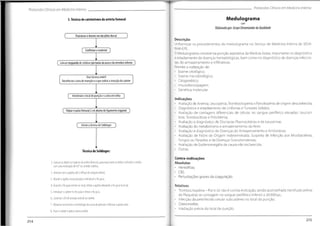 Protocolos Clínicos em Medicino Interna
Protocolos Clínicos em Medicino Interno
Medulograma
3.Técnica de cateterismo da artéria femoral
Elaborado por:Grupo Dinamizador daQualidade
Posicionar o doente em decúbito dorsal
Descrição
Uniformizar os procedimentos do medulograma no Serviço de Medicina Interna do SESA-
RAM-EPE.
0Medulograma consiste na punção aspirativa da Medula óssea,importante no diagnóstico
e estadiamento de doenças hematológicas, bem como no diagnóstico de doenças infeccio-
sas,do armazenamento e infiltrativas.
Permite a realização de:
• Exame citoiógico;
• Exame microbioiógico;
• Citogenético;
• Imunofenotipagem;
• Genética molecular.
f Confirmar o material j
i
( Colocar resguardodecelulosepor baixo da anca e domembroinferior )
Usartécnica estéril
Desinfectar a área deinserção e a que rodeia a inserçãodo cateter
f Anestesiaro localdepunção e a área emvolta j
Indicações
• Avaliação de Anemia,Leucopénia,Trombocitopénia e Pancitopénia de origem desconhecida;
• Diagnóstico e estadiamento de Linfomas eTumores Sólidos;
• Avaliação de contagens diferenciais de células no sangue periférico elevadas: Leucoci-
tose,Trombocitose e Policitémia;
• Avaliação e diagnóstico de Discrasias Plasmocitárias e de Leucemias
• Avaliação do metabolismo e armazenamento do ferro
• Avaliação e diagnóstico de Doenças do Armazenamento e Amiloidose;
• Avaliação de Febre de Origem Indeterminada, Suspeita de Infecção por Micobactérias,
Fungos ou Parasitas e de Doenças Granulomatosas;
• Avaliação de Esplenomegália de causa não esclarecida;
• Outras.
( Palparo pulso femural 2 cm abaixodoligamentoinguinal J
f Iniciar a técnica de Seldinger )
Técnica de Seldinger:
Contra-indicações
Absolutas
• FHemofilias;
• CID;
• Perturbações graves da coagulação.
1. Colocar os dedos no trajecto da artéria femoral,puncionar entre os dedosindicador e médio
com uma inclinação de 45°no sentido cefálico.
2. Avançar com a agulha até o refluxo desangue arterial.
3. Manter a agulha nessa posição e introduzir o fio guia.
4. Quando o fio guia estiver no local,retirar a agulha deixando o fo guia no local.
5.Introduzir o cateter no fio guia e retirar o fio guia.
6. Conectar oKitde pressão arterial ao cateter.
7. Observar no monitor a morfologia da curva de pressão e efectuar o ponto zero.
8.Fixar o cateter e aplicar penso estéril.
Relativas
• Trombocitopénia - Por si só não é contra-indicação,sendo aconselhada transfusão prévia
de Plaquetas se contagem no sangue periférico inferior a 20.000/pL;
• Infecção da pele/tecido celular subcutâneo no local da punção;
• Osteomielite;
• Irradiação prévia do local de punção.
215
214
 