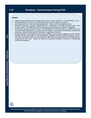 PEARLS:
These protocols, policies, and procedures MAY NOT be altered or modified except by the Rhode Island Department of Health Center for EMS.
Contact RI DOH EMS with suggestions for corrections, improvements, or modifications.
7.27 Procedure - Transcutaneous Pacing (TCP)
7.27Procedure-TranscutaneousPacing(TCP)
 Adult pacing/multifunction therapy pads may be used in patients > 15 kg (33 lbs) or 1 yo.
 Avoid placement of pads over bony prominences of the spine or scapula.
 Ensure good skin contact with pad application. Shave hair if situation permits.
 Electrical capture is usually represented by a widening of the QRS complex and a tall,
broad T wave. The deflection of the captured complex may be positive or negative.
 If electrical capture occurs without corresponding mechanical capture, consider/rule out
the following: hypovolemia, tension pneumothorax, pericardial tamponade, pulmonary
embolus, extensive myocardial infarction, or profound acidosis.
 Strong muscular contractions may make it difficult to accurately palpate a pulse. When
pacing with the electrodes in the AP position, palpation of the carotid, brachial or femo-
ral artery should be done on the patient’s right side and blood pressure should also be
measured on this side. Utilize an oximetric (arterial) waveform to assist in identifying
mechanical capture.
 