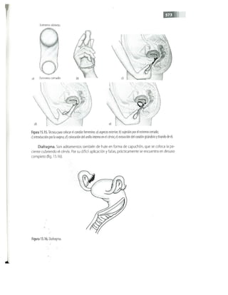 OBSTECTRICIA ILUSTRADA TERCERA PARTE
