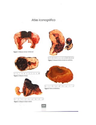 OBSTECTRICIA ILUSTRADA TERCERA PARTE