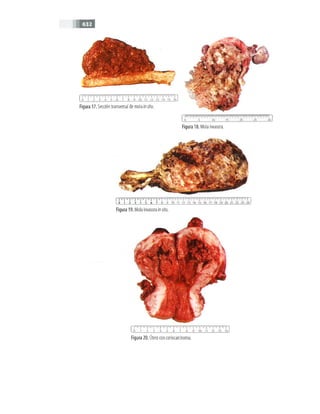 OBSTECTRICIA ILUSTRADA TERCERA PARTE