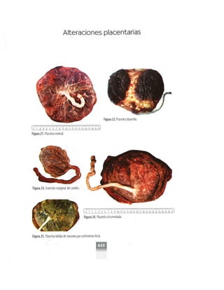 OBSTECTRICIA ILUSTRADA TERCERA PARTE