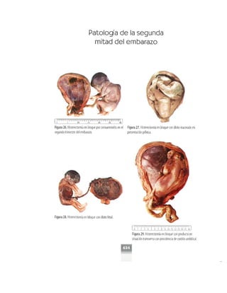 OBSTECTRICIA ILUSTRADA TERCERA PARTE