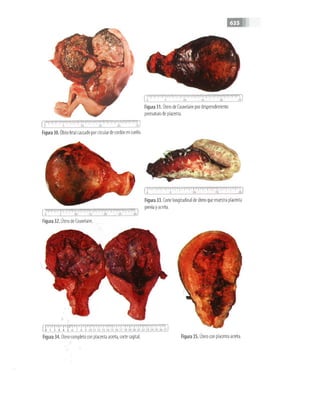 OBSTECTRICIA ILUSTRADA TERCERA PARTE