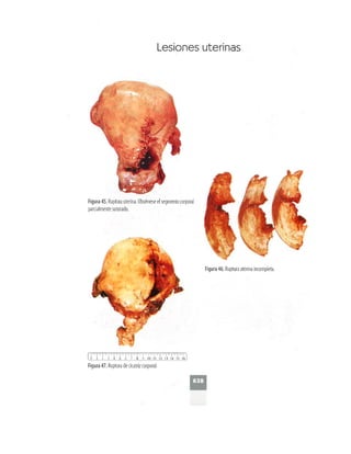 OBSTECTRICIA ILUSTRADA TERCERA PARTE