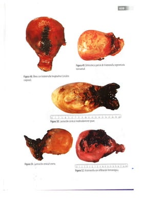 OBSTECTRICIA ILUSTRADA TERCERA PARTE