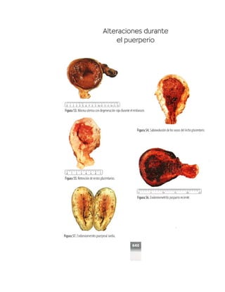 OBSTECTRICIA ILUSTRADA TERCERA PARTE