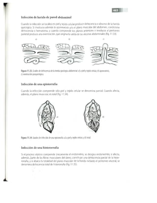 OBSTECTRICIA ILUSTRADA TERCERA PARTE