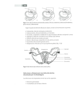 OBSTECTRICIA ILUSTRADA TERCERA PARTE