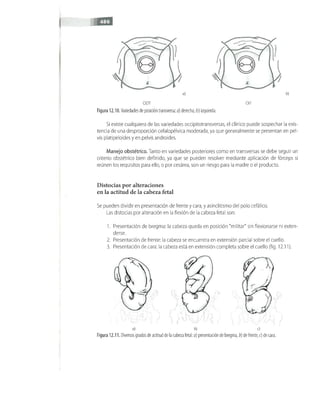 OBSTECTRICIA ILUSTRADA TERCERA PARTE