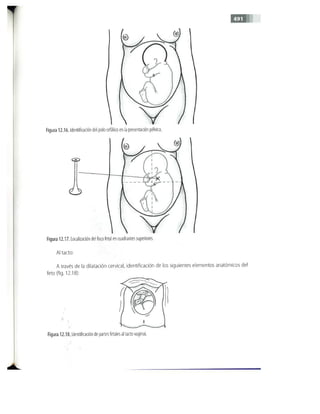OBSTECTRICIA ILUSTRADA TERCERA PARTE