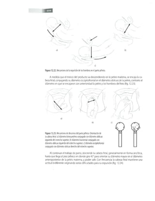 OBSTECTRICIA ILUSTRADA TERCERA PARTE