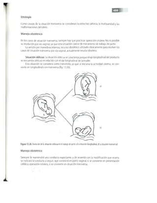 OBSTECTRICIA ILUSTRADA TERCERA PARTE