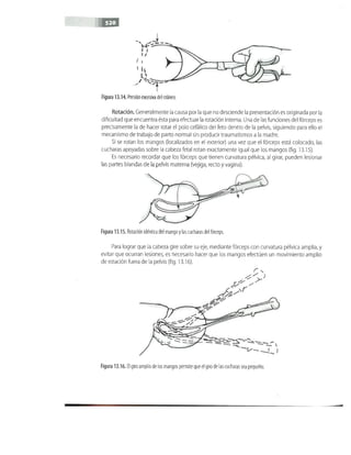 OBSTECTRICIA ILUSTRADA TERCERA PARTE