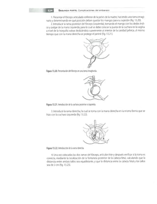 OBSTECTRICIA ILUSTRADA TERCERA PARTE