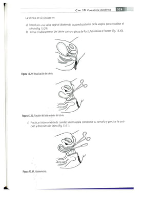 OBSTECTRICIA ILUSTRADA TERCERA PARTE