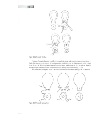 OBSTECTRICIA ILUSTRADA TERCERA PARTE