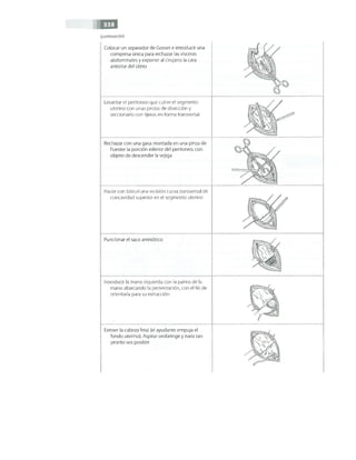 OBSTECTRICIA ILUSTRADA TERCERA PARTE
