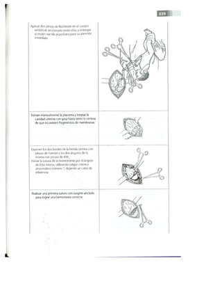 OBSTECTRICIA ILUSTRADA TERCERA PARTE