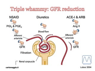 carlomaggio.it
NSAID
PGI2 & PGE2
ACE-I & ARB
GFR
Ang II
GFR
Diuretics
GFR
Loboz 2004
 