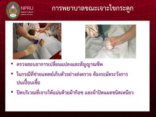 การพยาบาลขณะเจาะไขกระดูก
• ตรวจสอบอาการเปลี่ยนแปลงและสัญญาณชีพ
• ในกรณีที่ช่วยแพทย์เก็บตัวอย่างส่งตรวจ ต้องระมัดระวังการ
ปนเปื้อนเชื้อ
• ปิดบริเวณที่เจาะให้แน่นด้วยผ้าก๊อซ และผ้าปิดแผลชนิดเหนียว
 