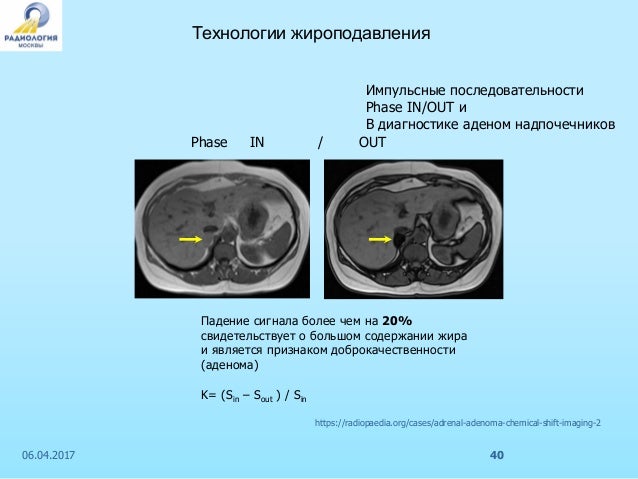 Формирование кт изображений основано на