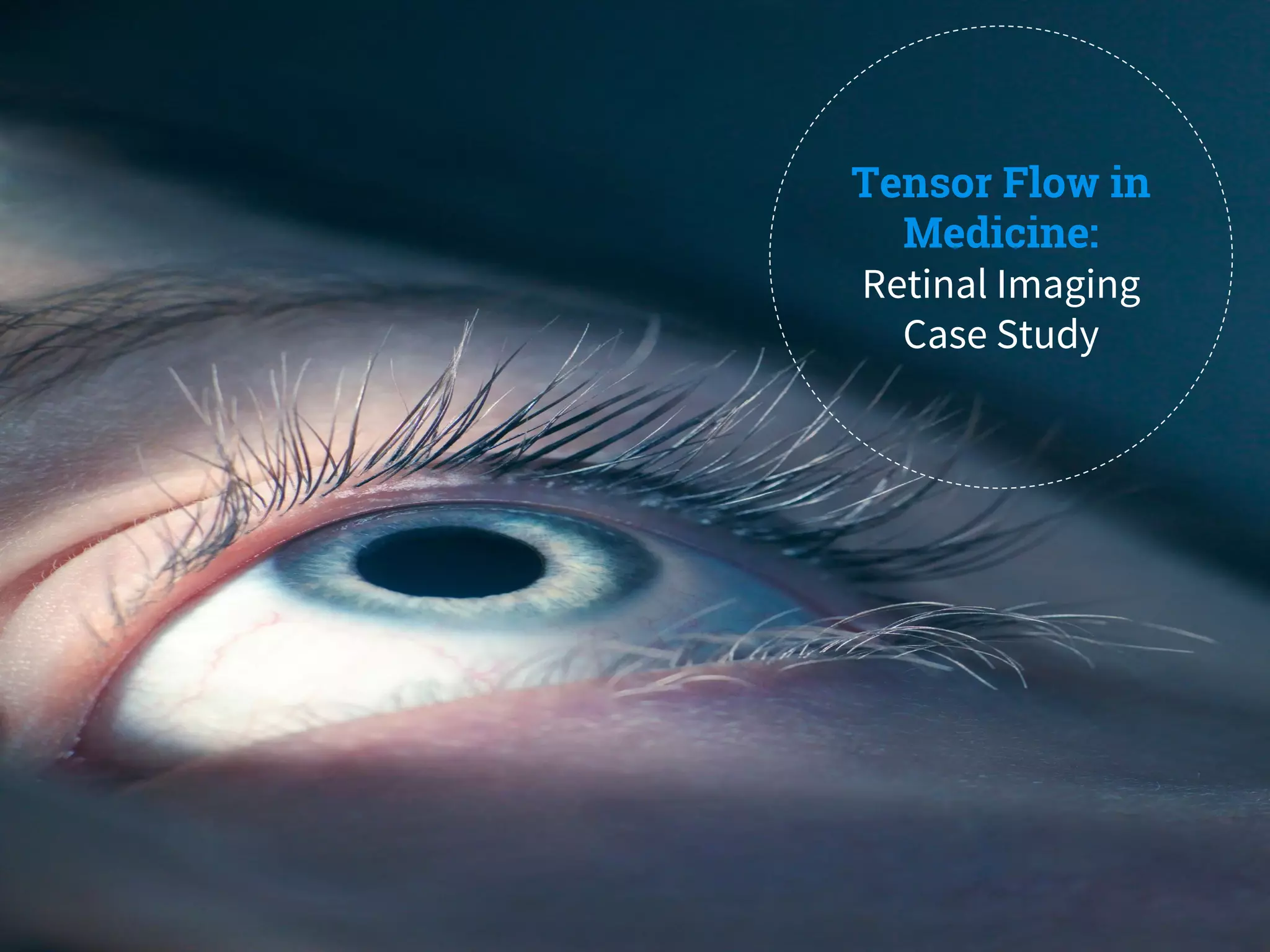 Tensor Flow in
Medicine:
Retinal Imaging
Case Study
 