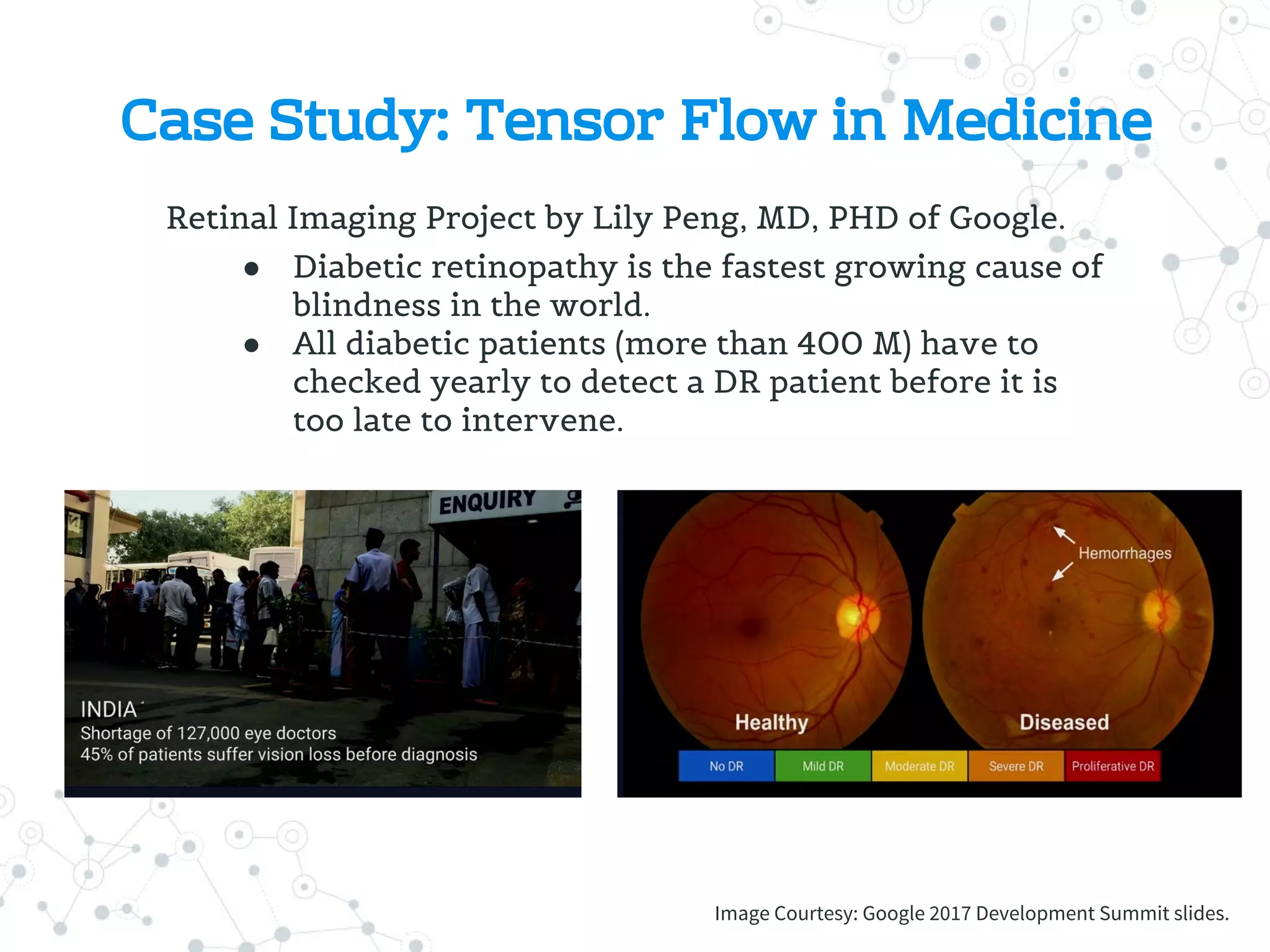 Case Study: Tensor Flow in Medicine
Retinal Imaging Project by Lily Peng, MD, PHD of Google.
● Diabetic retinopathy is the fastest growing cause of
blindness in the world.
● All diabetic patients (more than 400 M) have to
checked yearly to detect a DR patient before it is
too late to intervene.
Image Courtesy: Google 2017 Development Summit slides.
 