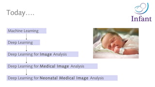 Today….
Machine Learning
Deep Learning
Deep Learning for Image Analysis
Deep Learning for Medical Image Analysis
Deep Learning for Neonatal Medical Image Analysis
 