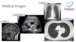 Medical Images
X-Ray
CT
Ultrasound
MRI
 
