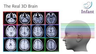 The Real 3D Brain
 