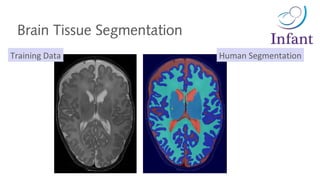 Brain Tissue Segmentation
Human SegmentationTraining Data
 