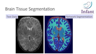 Network SegmentationTest Data
Brain Tissue Segmentation
 