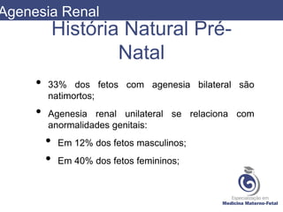 História Natural Pré-
Natal
• 33% dos fetos com agenesia bilateral são
natimortos;
• Agenesia renal unilateral se relaciona com
anormalidades genitais:
• Em 12% dos fetos masculinos;
• Em 40% dos fetos femininos;
Agenesia Renal
 