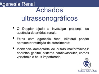 Achados
ultrassonográficos
• O Doppler ajuda a investigar presença ou
ausência de artérias renais;
• Fetos com agenesia renal bilateral podem
apresentar restrição de crescimento;
• Incidência aumentada de outras malformações:
aparelho genital, sistema cardiovascular, corpos
vertebrais e ânus imperfurado
Agenesia Renal
 