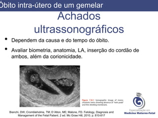 Achados
ultrassonográficos
• Dependem da causa e do tempo do óbito.
• Avaliar biometria, anatomia, LA, inserção do cordão de
ambos, além da corionicidade.
Bianchi, DW; Crombleholme, TM; D´Alton, ME; Malone, FD. Fetology, Diagnosis and
Management of the Fetal Patient. 2 ed. Mc Graw Hill, 2010. p. 810-817
Óbito intra-útero de um gemelar
 