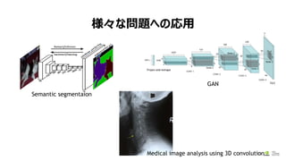 ʆ}ؤΏ
20
Semantic segmentaion
GAN
Medical image analysis using 3D convolution
 