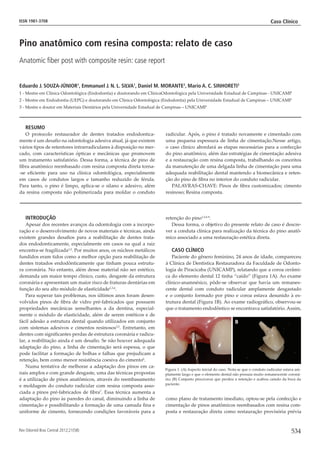 Rev Odontol Bras Central 2012;21(58)
Caso Clínico
534
ISSN 1981-3708
Introdução
Apesar dos recentes avanços da odontologia com a incorpo-
ração e o desenvolvimento de novos materiais e técnicas, ainda
existem grandes desafios para a reabilitação de dentes trata-
dos endodonticamente, especialmente em casos na qual a raiz
encontra-se fragilizada1,2
. Por muitos anos, os núcleos metálicos
fundidos eram tidos como a melhor opção para reabilitação de
dentes tratados endodônticamente que tinham pouca estrutu-
ra coronária. No entanto, além desse material não ser estético,
demanda um maior tempo clínico, custo, desgaste da estrutura
coronária e apresentam um maior risco de fraturas dentárias em
função do seu alto módulo de elasticidade1,3,4
.
Para superar tais problemas, nos últimos anos foram desen-
volvidos pinos de fibra de vidro pré-fabricados que possuem
propriedades mecânicas semelhantes a da dentina, especial-
mente o módulo de elasticidade, além de serem estéticos e de
fácil adesão a estrutura dental quando utilizados em conjunto
com sistemas adesivos e cimentos resinosos3,5
. Entretanto, em
dentes com significantes perdas de estrutura coronária e radicu-
lar, a reabilitação ainda é um desafio. Se não houver adequada
adaptação do pino, a linha de cimentação será espessa, o que
pode facilitar a formação de bolhas e falhas que prejudicam a
retenção, bem como menor resistência coesiva do cimento6
.
Numa tentativa de melhorar a adaptação dos pinos em ca-
nais amplos e com grande desgaste, uma das técnicas propostas
é a utilização de pinos anatômicos, através do reembasamento
e moldagem do conduto radicular com resina composta asso-
ciada a pinos pré-fabricados de fibra7
. Essa técnica aumenta a
adaptação do pino às paredes do canal, diminuindo a linha de
cimentação e possibilitando a formação de uma camada fina e
uniforme de cimento, fornecendo condições favoráveis para a
retenção do pino1,2,6-9
.
Dessa forma, o objetivo do presente relato de caso é descre-
ver a conduta clínica para realização da técnica do pino anatô-
mico associado a uma restauração estética direta.
Caso clínico
Paciente do gênero feminino, 24 anos de idade, compareceu
à Clínica de Dentística Restauradora da Faculdade de Odonto-
logia de Piracicaba (UNICAMP), relatando que a coroa cerâmi-
ca do elemento dental 12 tinha “caído” (Figura 1A). Ao exame
clínico-anamnésico, pôde-se observar que havia um remanes-
cente dental com conduto radicular amplamente desgastado
e o conjunto formado por pino e coroa estava desunido à es-
trutura dental (Figura 1B). Ao exame radiográfico, observou-se
que o tratamento endodôntico se encontrava satisfatório. Assim,
como plano de tratamento imediato, optou-se pela confecção e
cimentação de pinos anatômicos reembasados com resina com-
posta e restauração direta como restauração provisória prévia
Pino anatômico com resina composta: relato de caso
Anatomic fiber post with composite resin: case report
Eduardo J. Souza-Júnior1
, Emmanuel J. N. L. Silva1
, Daniel M. Morante2
, Mario A. C. Sinhoreti3
1 - Mestre em Clínica Odontológica (Endodontia) e doutorando em ClínicaOdontológica pela Universidade Estadual de Campinas - UNICAMP
2 - Mestre em Endodontia (UEPG) e doutorando em Clínica Odontológica (Endodontia) pela Universidade Estadual de Campinas – UNICAMP
3 - Mestre e doutor em Materiais Dentários pela Universidade Estadual de Campinas – UNICAMP
Resumo
O protocolo restaurador de dentes tratados endodontica-
mente é um desafio na odontologia adesiva atual, já que existem
vários tipos de retentores intrarradiculares à disposição no mer-
cado, com características ópticas e mecânicas que promovem
um tratamento satisfatório. Dessa forma, a técnica de pino de
fibra anatômico reembasado com resina composta direta torna-
-se eficiente para uso na clínica odontológica, especialmente
em casos de condutos largos e tamanho reduzido de férula.
Para tanto, o pino é limpo, aplica-se o silano e adesivo, além
da resina composta não polimerizada para moldar o conduto
radicular. Após, o pino é tratado novamente e cimentado com
uma pequena espessura de linha de cimentação.Nesse artigo,
o caso clinico abordará as etapas necessárias para a confecção
do pino anatômico, além das estratégias de cimentação adesiva
e a restauração com resina composta, trabalhando os conceitos
da manutenção de uma delgada linha de cimentação para uma
adequada reabilitação dental mantendo a biomecânica e reten-
ção do pino de fibra no interior do conduto radicular.
PALAVRAS-CHAVE: Pinos de fibra customizados; cimento
resinoso; Resina composta.
A B
Figura 1. (A) Aspecto inicial do caso. Nota-se que o conduto radicular estava am-
plamente largo e que o elemento dental não possuia muito remanescente coroná-
rio; (B) Conjunto pino/coroa que perdeu a retenção e acabou caindo da boca da
paciente.
 
