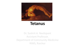 Tetanus
Dr. Sushrit A. Neelopant
Assistant Professor,
Department of Community Medicine
RIMS, Raichur
 