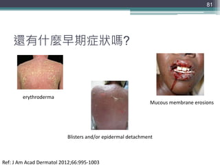 還有什麼早期症狀嗎?
81
erythroderma
Mucous membrane erosions
Blisters and/or epidermal detachment
Ref: J Am Acad Dermatol 2012;66:995-1003
 