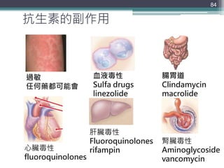 抗生素的副作用
84
心臟毒性
fluoroquinolones
肝臟毒性
Fluoroquinolones
rifampin
腎臟毒性
Aminoglycoside
vancomycin
過敏
任何藥都可能會
血液毒性
Sulfa drugs
linezolide
腸胃道
Clindamycin
macrolide
 