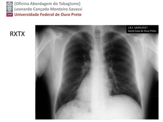 [Oficina Abordagem do Tabagismo]
Leonardo Cançado Monteiro Savassi
Universidade Federal de Ouro Preto
RXTX
J.B.S. 14/05/2017
Santa Casa de Ouro Preto
 