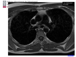 [Oficina Abordagem do Tabagismo]
Leonardo Cançado Monteiro Savassi
Universidade Federal de Ouro Preto
J.B.S. 08/01/2019
HC UFMG
VOLTAR
 