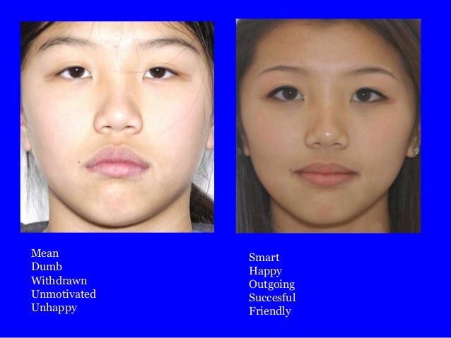 faces first and treatment