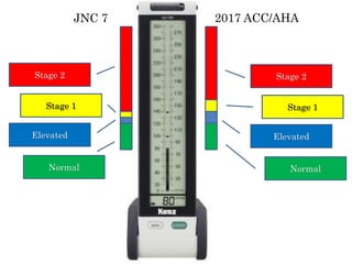 JNC 7 2017 ACC/AHA
Normal
Elevated
Stage 1
Stage 2
Normal
Elevated
Stage 1
Stage 2
 